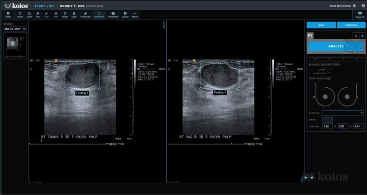 Lev Barinov, photo 1