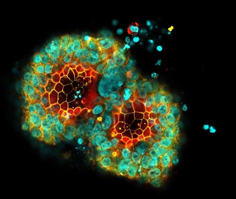 Chase Bishop, photo 2