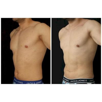 Cavit Ilker, photo 2