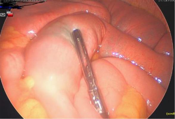 Darmendra Ramcharran, photo 1