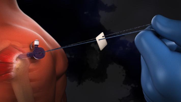 Cody Fuller, photo 2