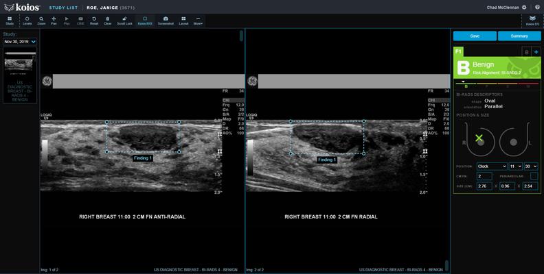 Lev Barinov, photo 2