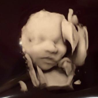 Prakash Balakrishnan, photo 1