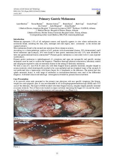 Iris Beharaj, photo 1