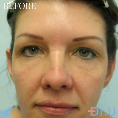 Sanusi Umar, photo 2