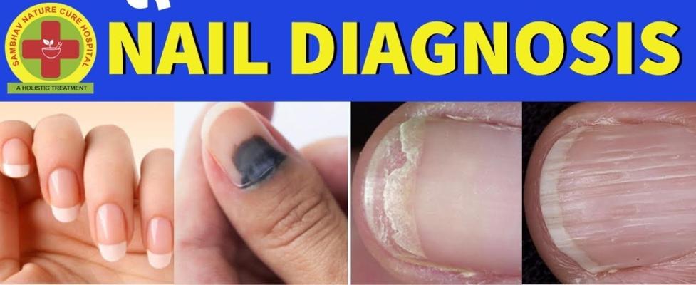 Nils Finger, photo 1