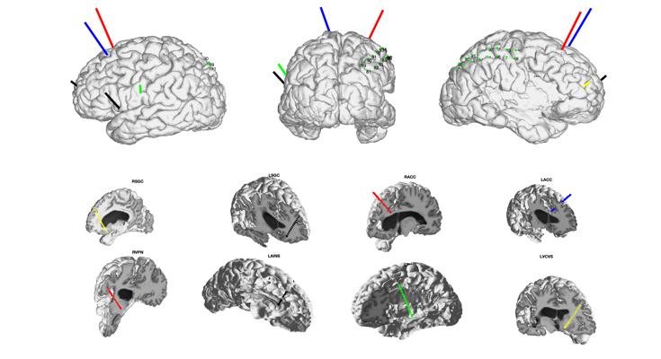 Dean Brancucci, photo 2