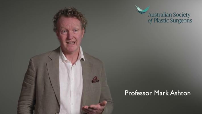 Mark Ashton, photo 2